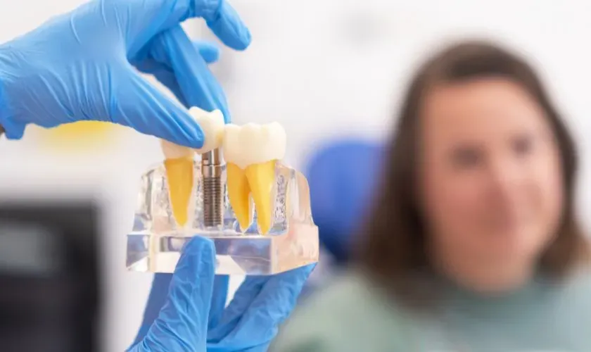 Dental Implant Healing: 4 Key Stages of Recovery