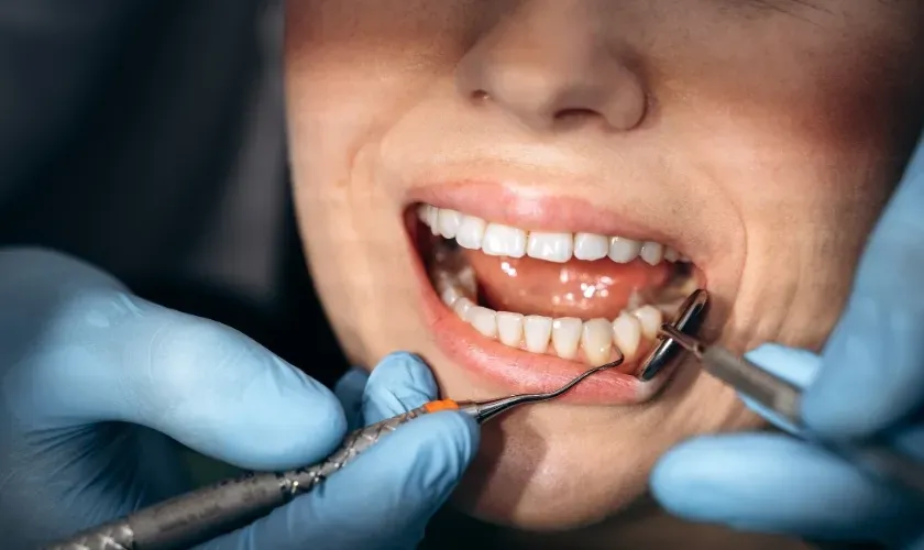 Dental Implant: The Smartest Choice for Missing Teeth