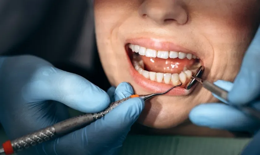 What Causes Someone to Grind Their Teeth?