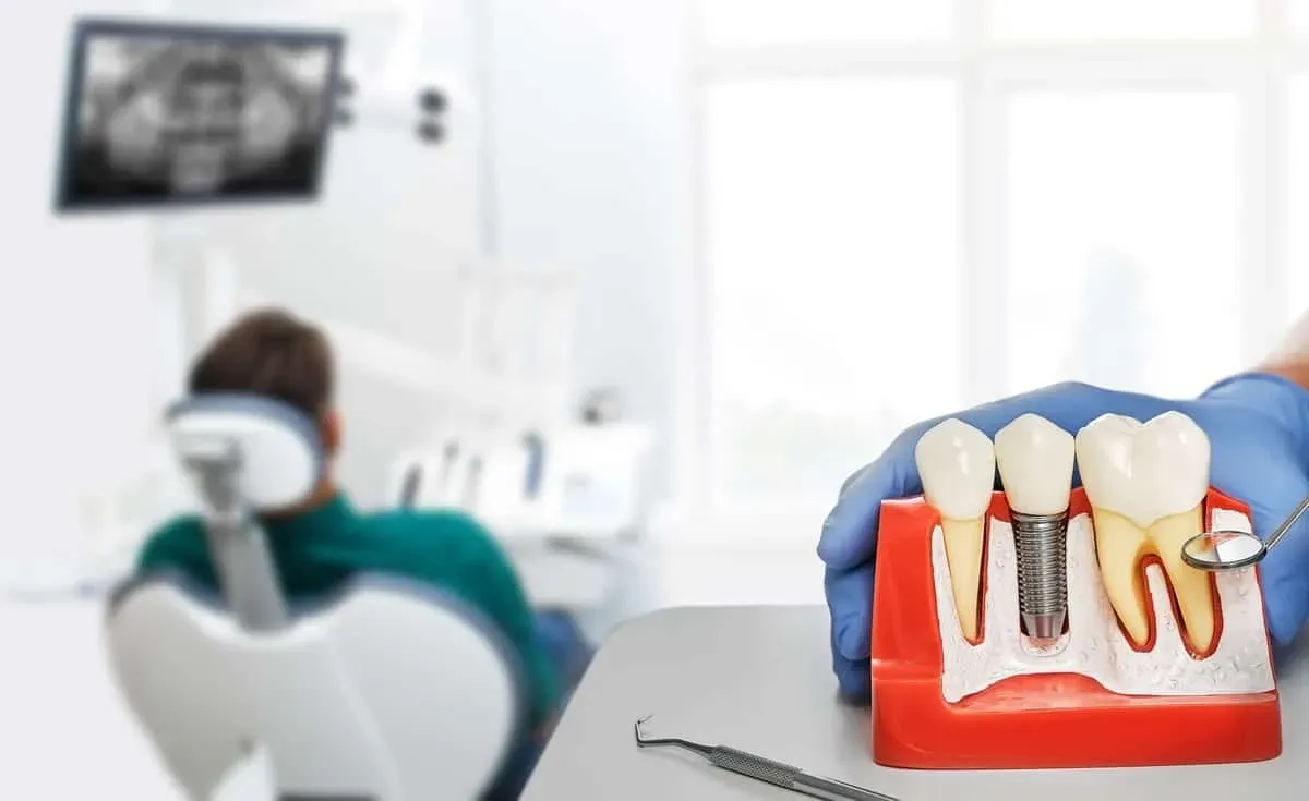 Dental Bridges Last 10 Years—Here's What Extends Yours Beyond That