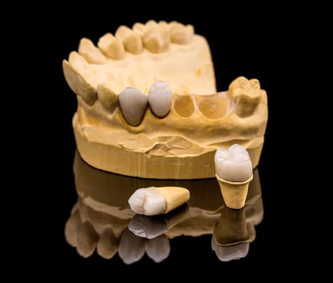 Dental Crown Care Tips in Fort Worth, TX