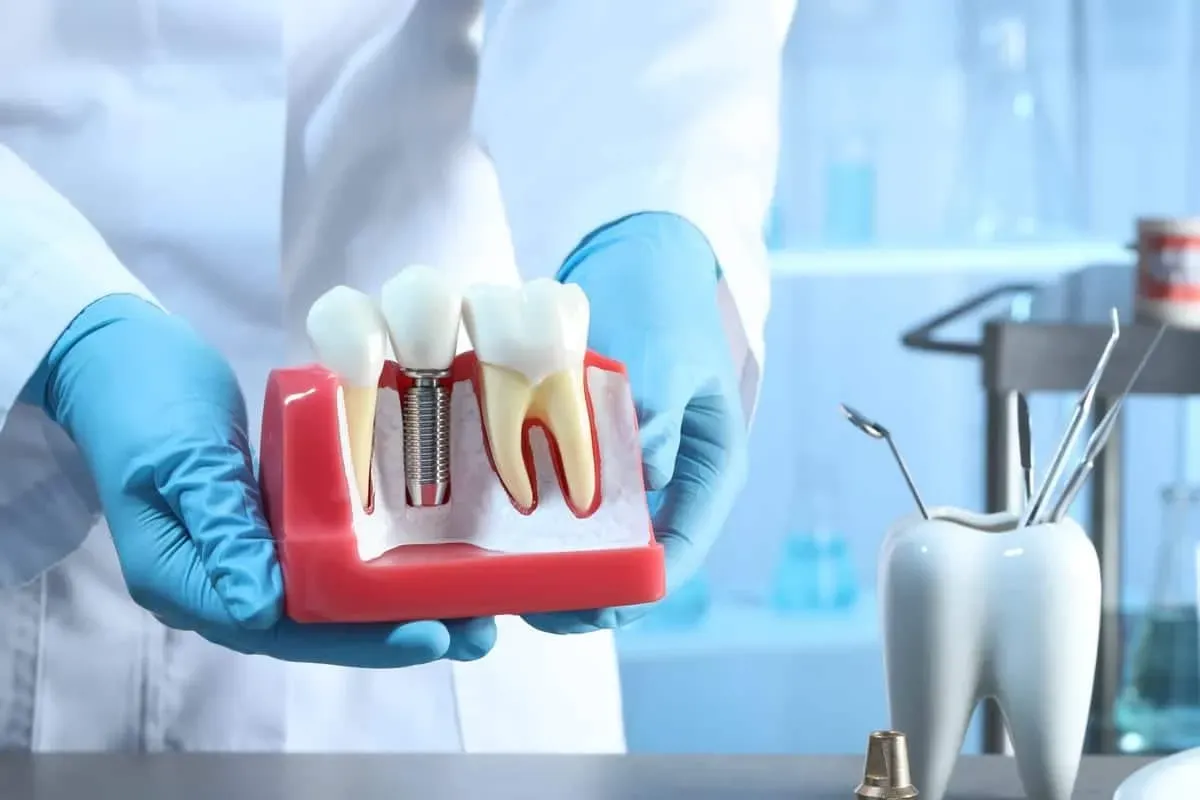 Dental Implant Recovery Week by Week