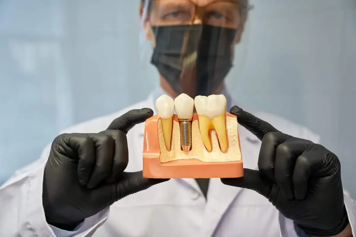 Dental Implants Last 20+ Years: Here's What Actually Determines Yours