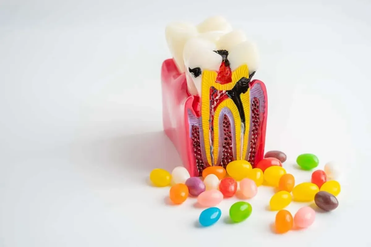 Root Canal Pain: What to Expect in Fort Worth, TX