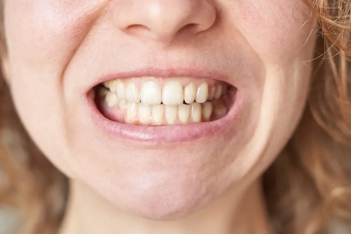 5 Questions New Patients Ask Before Starting Gum Disease Treatment