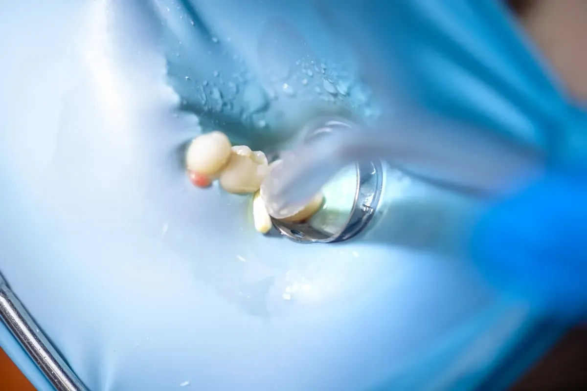 What to Expect After Your Root Canal: A Recovery Guide