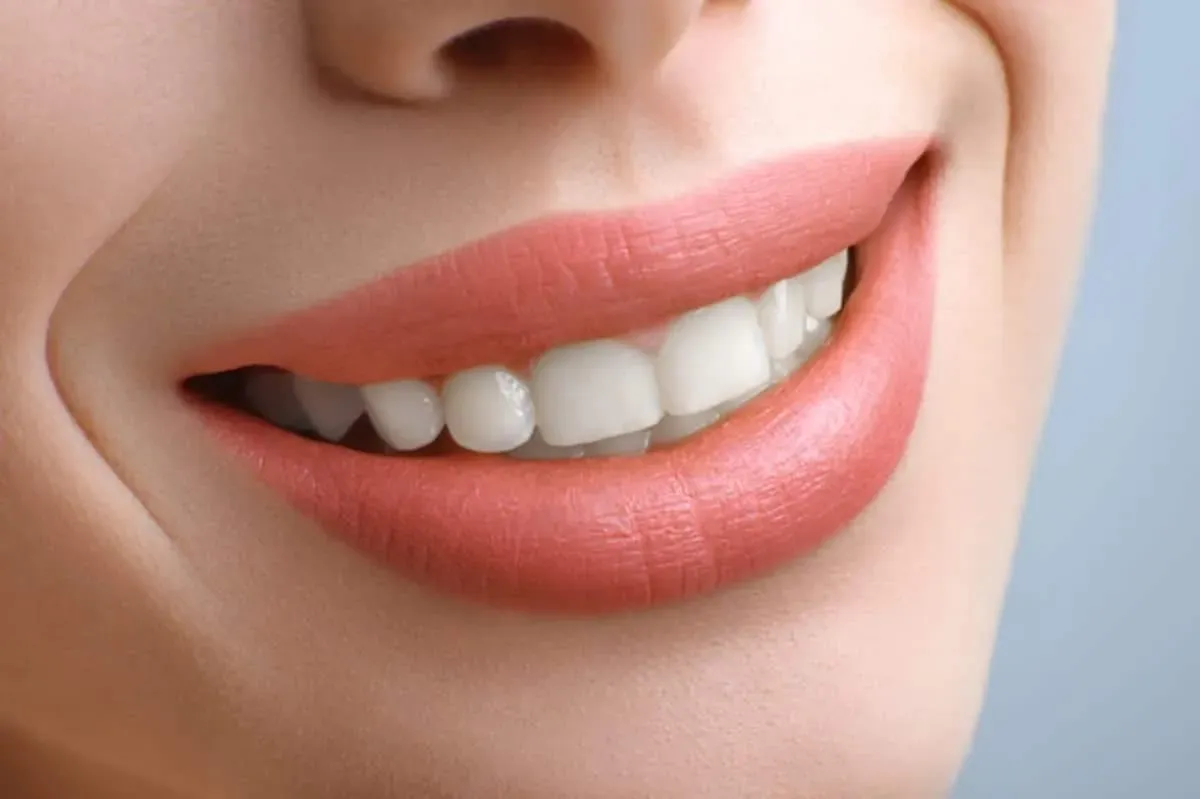 Teeth Whitening Timeline in Haltom City, TX