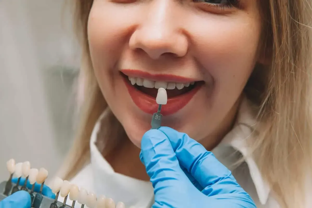 Porcelain vs. Composite Veneers in Blue Mound, TX
