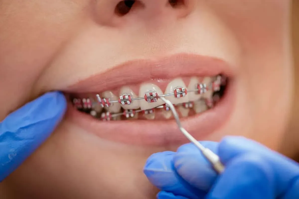 Restorative Dental Treatment in Blue Mound, TX