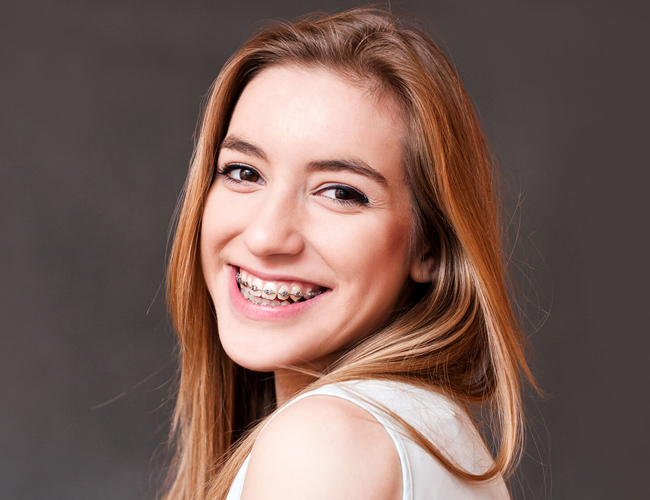 Orthodontics Fort Worth TX - Flossophy Dental Studio