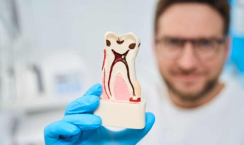 Relieve Pain After a Root Canal Treatment