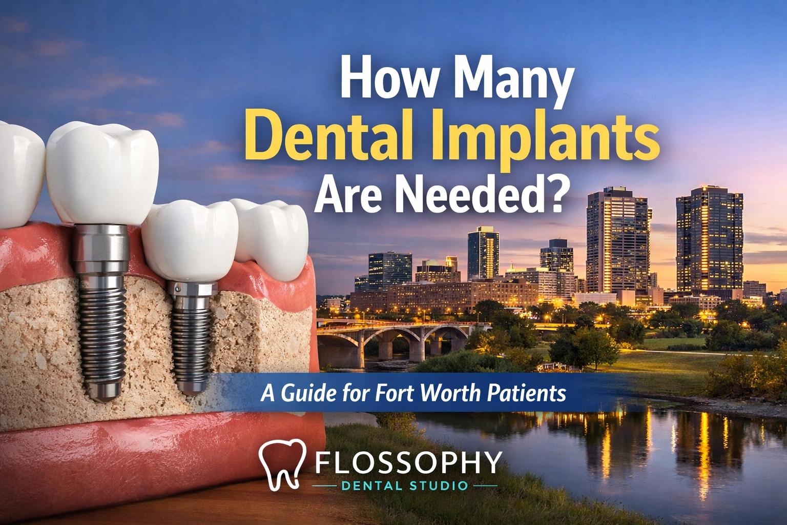 Illustration showing dental implants and crowns explaining how many dental implants are needed for tooth replacement